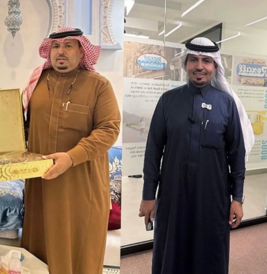 صورة قبل وبعد لأحد المشتركين في البرنامج (1)