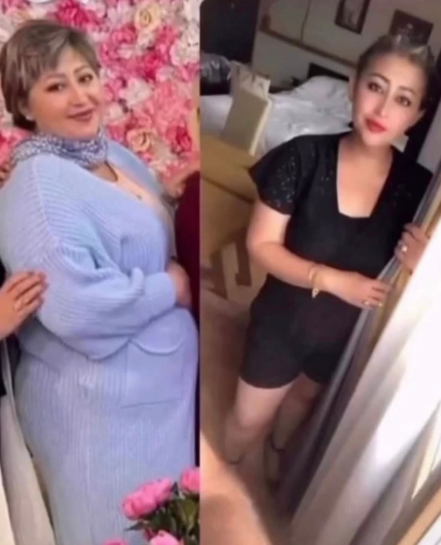 صورة قبل وبعد لأحد المشتركين في البرنامج (6)